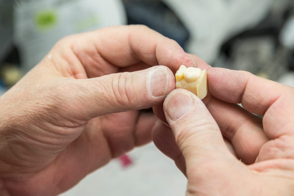 Dental Crowns in Taylor