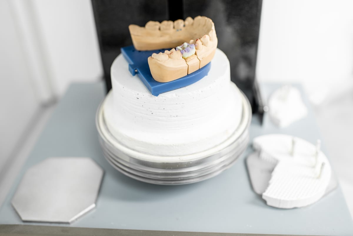 Dental Crowns in Taylor